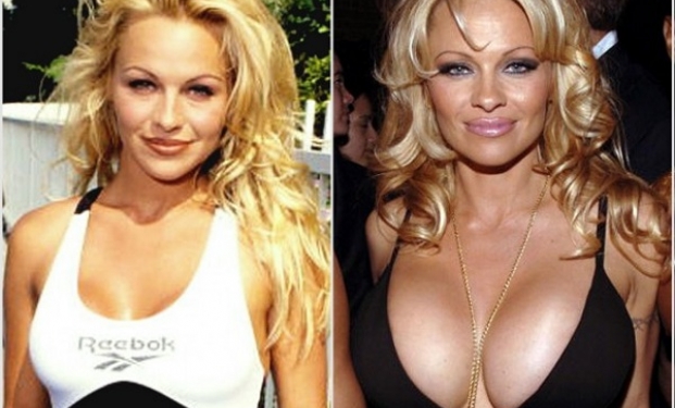 Pamela Anderson